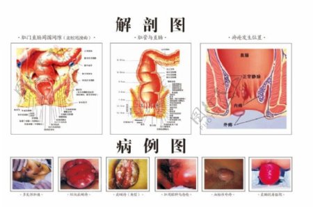 解剖圖