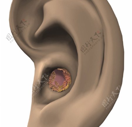 耳耳朵图片