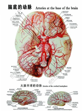 脑底动脉图图片