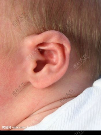 婴儿的耳朵图片
