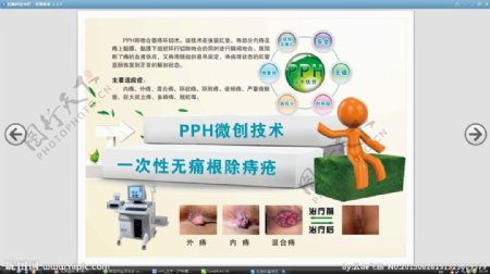 肛肠科PPH宣传展板图片