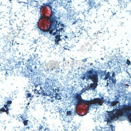 新鲜粪便样品其中已用10溶液制备用番红染色的此显微照片显示了