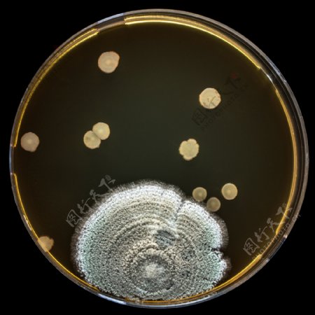 培养皿里的超大病菌图片