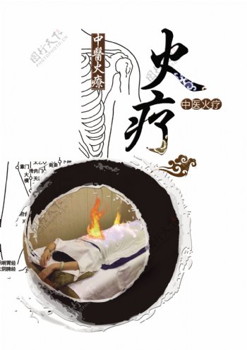 中医火疗传统文化艺术字设计